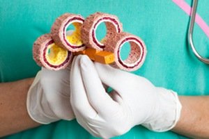 Атеросклероз: симптомы, лечебная профилактика