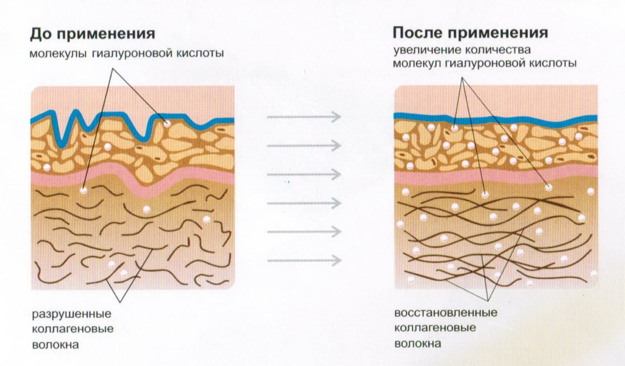 Коллаген в коже