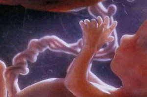Задержка внутриутробного развития плода