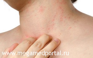 Причины и лечение кожного зуда