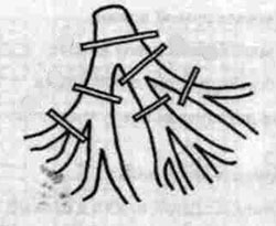 blokada-nogek-puchka-Gisa