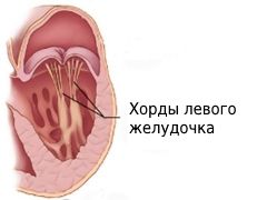 hordy-levogo-geludochka