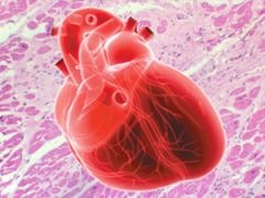 miocardiofibroz.jpg